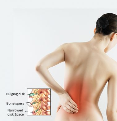 Lower Back Pain