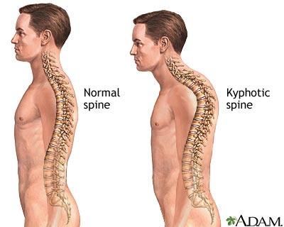 Desk Posture