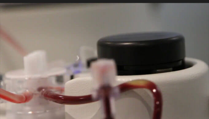 PRP Therapy